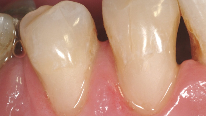 Figure4 630e51e029a00 6345ce5ca17ff