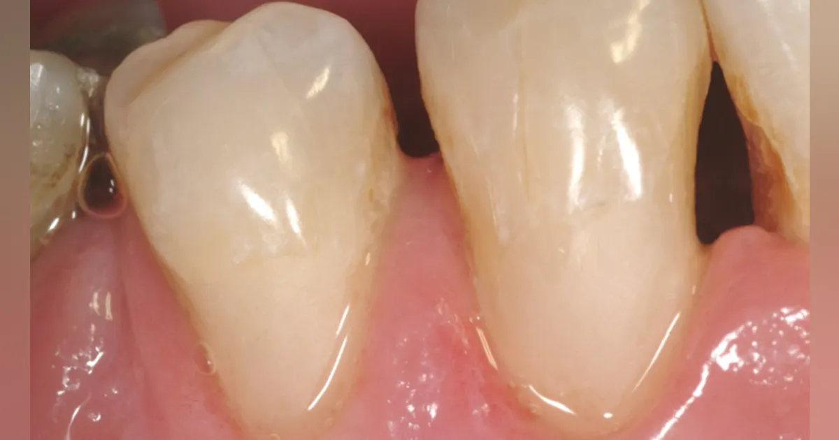 When older, proven clinical concepts might be better When older, proven clinical concepts might be better