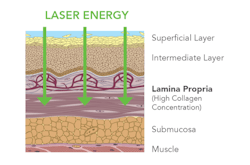 2211 De Clig P03 2211 De Clig P03