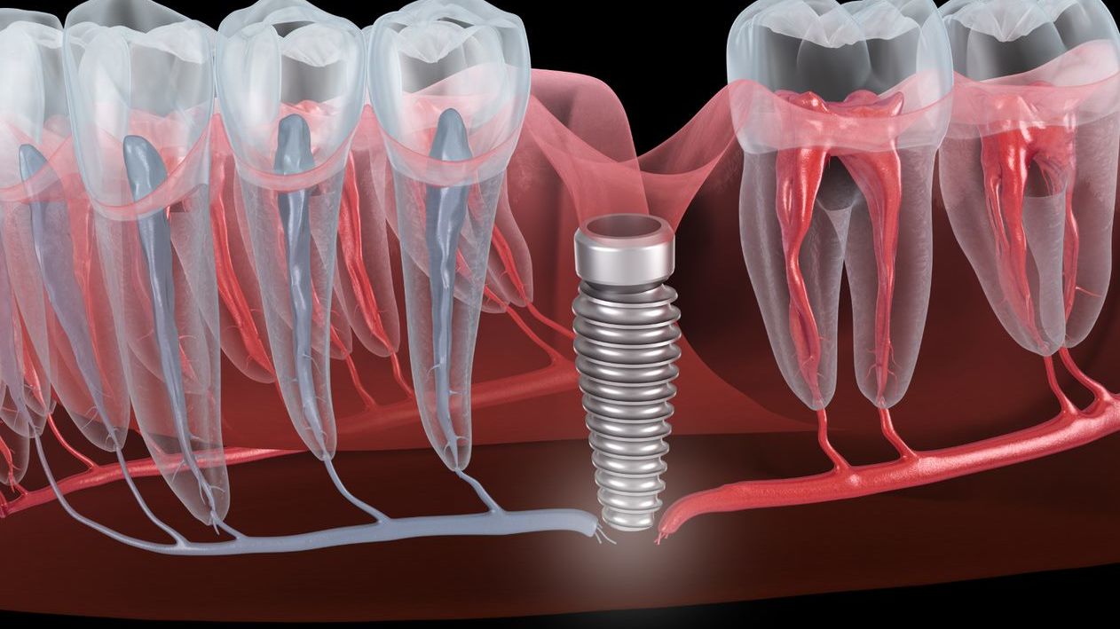 2211 De Cfro P01 636ad4865286c