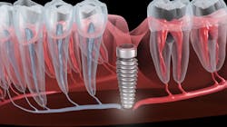 2211 De Cfro P01 636ad4865286c 2211 De Cfro P01 636ad4865286c