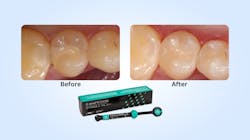 Before 639a0823b5b9e Before 639a0823b5b9e