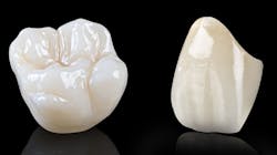 Figure 1: Zirconia crowns properly made, seated over adequate preps, and with the right cement can result in wonderful dental restorations that stay in place.