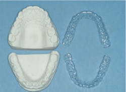 Figure 4: Fluoride (5,000 ppm) in trays is recommended for patients with high-caries activity.