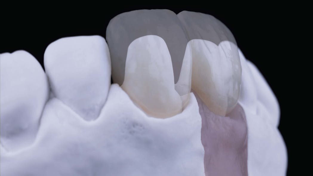 Figure 4: The end result of two separate bench-top photographs that were stitched together utilizing post-production photo editing software to create a single composite image
