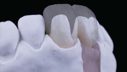 Figure 4: The end result of two separate bench-top photographs that were stitched together utilizing post-production photo editing software to create a single composite image Figure 4: The end result of two separate bench-top photographs that were stitched together utilizing post-production photo editing software to create a single composite image