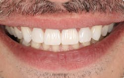 Figure 11: Completed case Figure 11: Completed case