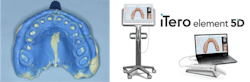 Figure 3: Vinyl polysiloxane and polyether are the most accurate impression methods in the history of dentistry. Is scanning more accurate? No, but scanners have other numerous advantages that make them desirable to dentists and patients. Patient acceptance of scanners and dentists’ desire to use technology has caused growth in scanner use. With needed significant improvements, scanners are the future of impressions. The most popular brand, iTero (Glidewell), is shown here. Figure 3: Vinyl polysiloxane and polyether are the most accurate impression methods in the history of dentistry. Is scanning more accurate? No, but scanners have other numerous advantages that make them desirable to dentists and patients. Patient acceptance of scanners and dentists’ desire to use technology has caused growth in scanner use. With needed significant improvements, scanners are the future of impressions. The most popular brand, iTero (Glidewell), is shown here.