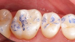 Figure28 63c06e063a6e8 63e421333b334 Figure28 63c06e063a6e8 63e421333b334