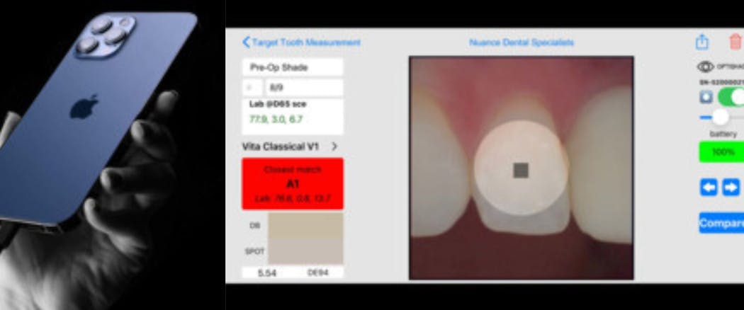 Figure 2: Smartphone technology and color-matching software utilized in the laboratory communication and fabrication of the all-ceramic restorations.