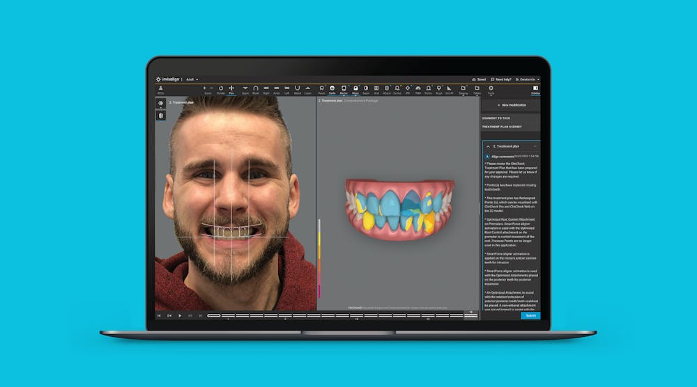 Product review: Invisalign Smile Architect by Align | Dental Economics
