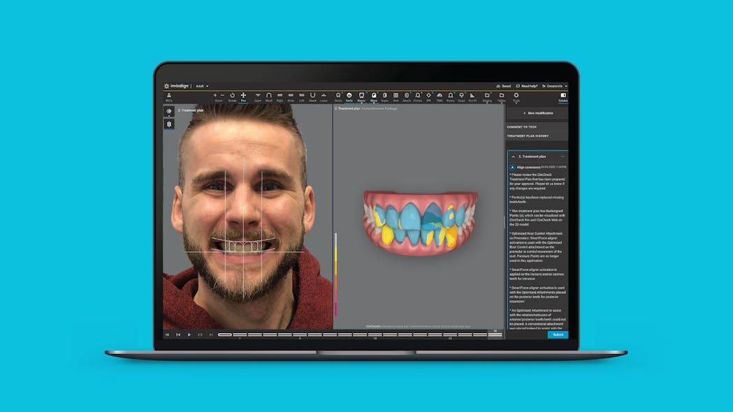 Pearls for Your Practice: Invisalign Smile Architect by Align | Dental ...