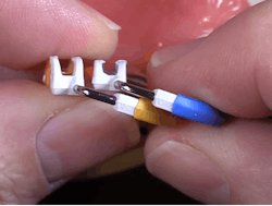 Figure 1: Note the angulation of the Composi-Tight 3D Fusion rings that allows for better stackability. Figure 1: Note the angulation of the Composi-Tight 3D Fusion rings that allows for better stackability.