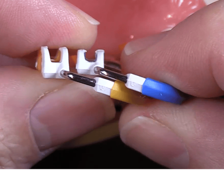 How Composi-Tight 3D Fusion Sectional Matrix System