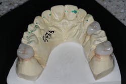 Figure 10: Lithium disilicate no. 13 Figure 10: Lithium disilicate no. 13