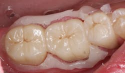 Figure 7: Ease of cleanup Figure 7: Ease of cleanup