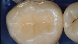 Fig2c 645eafba154a3 Fig2c 645eafba154a3