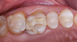 Figure1