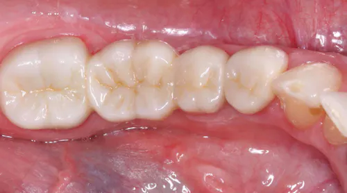 Perio Rinse for home use | Dental Economics