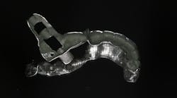 A printed titanium guide for a zygomatic implant A printed titanium guide for a zygomatic implant