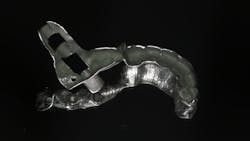 A printed titanium guide for a zygomatic implant A printed titanium guide for a zygomatic implant