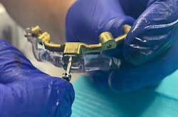 A milled surgical guide positioner with a stacking resin component A milled surgical guide positioner with a stacking resin component