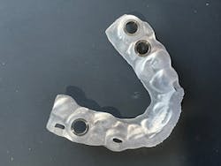 A conventional printed full arch resin surgical guide A conventional printed full arch resin surgical guide