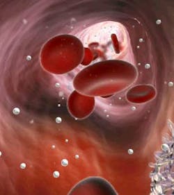 Figure 4: Before HBOT: red blood cells and oxygen molecules Figure 4: Before HBOT: red blood cells and oxygen molecules