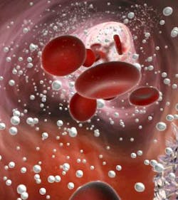 Figure 5: After HBOT: many more free oxygen molecules in the bloodstream Figure 5: After HBOT: many more free oxygen molecules in the bloodstream