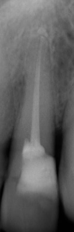 Figure 6: 2D showing a horizontal fracture Figure 6: 2D showing a horizontal fracture