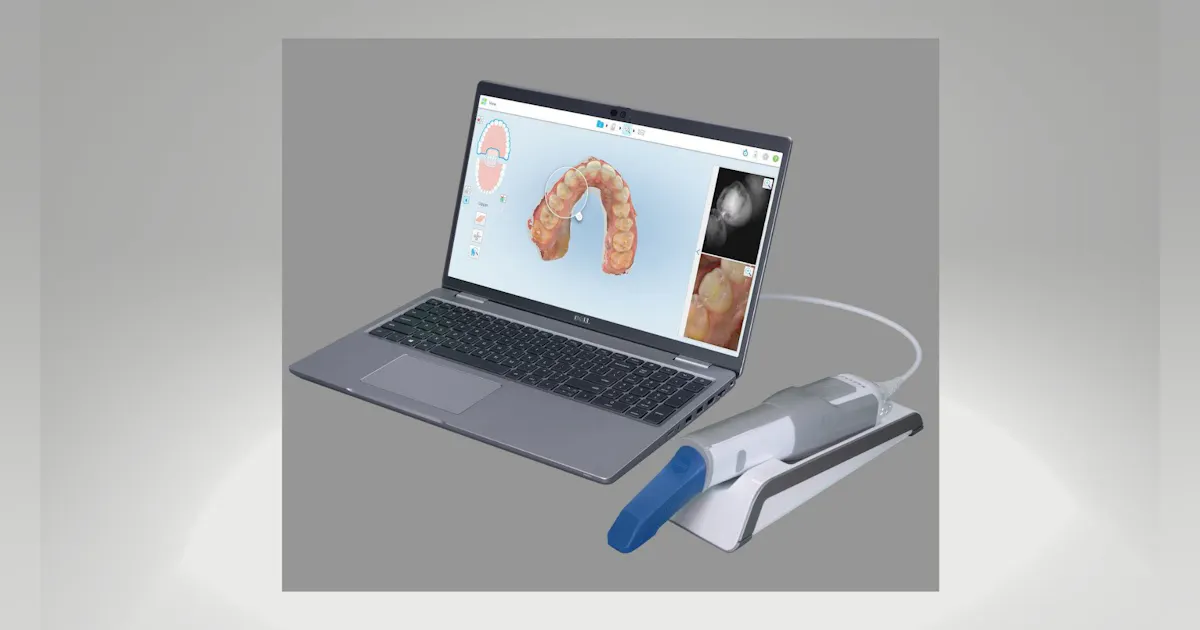 5d Scanning Unit Product review: iTero Element 5D Imaging System with Plus package and ...