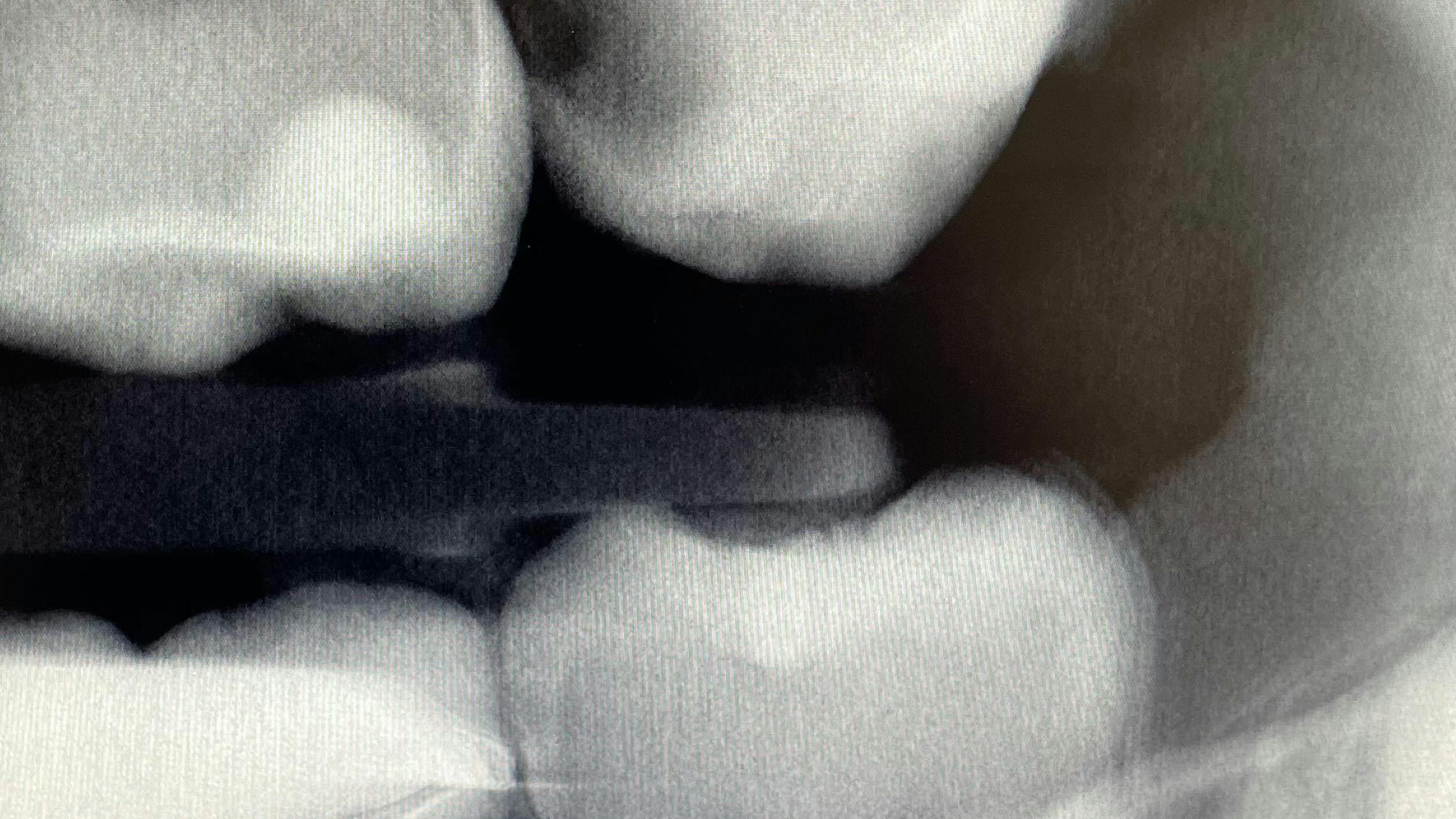 6556328ef9d24c001e33af52 3dtomosynthesisprimary