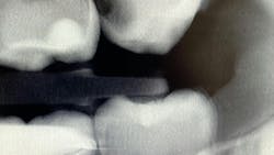 6556328ef9d24c001e33af52 3dtomosynthesisprimary 6556328ef9d24c001e33af52 3dtomosynthesisprimary