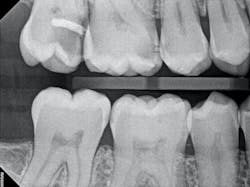 figure_1b_preop_bw figure_1b_preop_bw