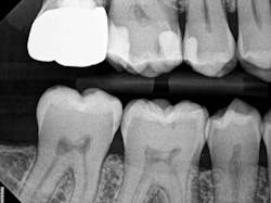 figure_4a_crown_delivery_bw figure_4a_crown_delivery_bw