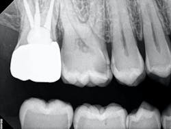 figure_4b_crown_delivery_bwpa figure_4b_crown_delivery_bwpa