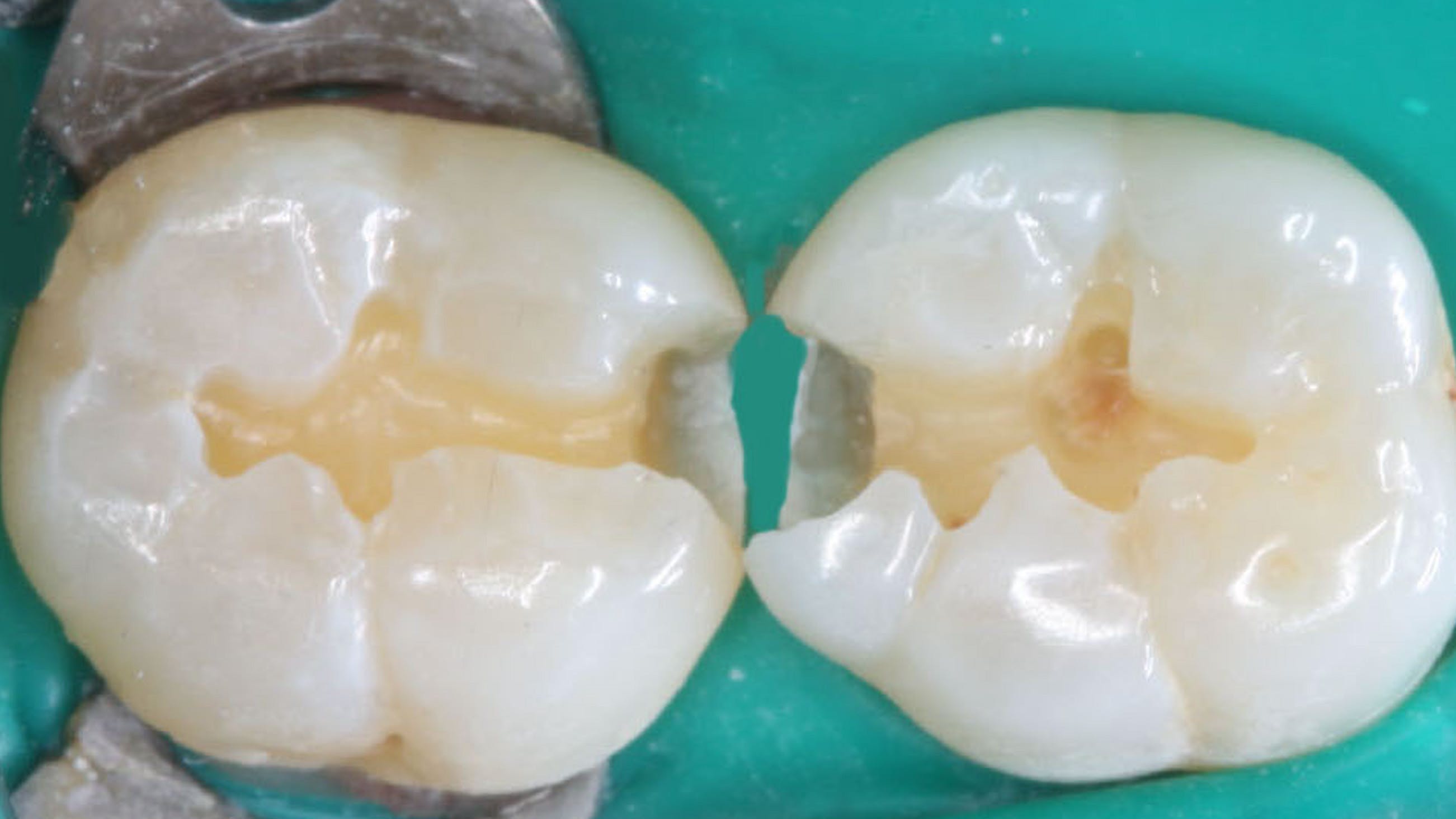 659ed2431d5ebe001f1aae62 Primary