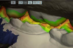 Figure 2: Intraoral scan. Note the available interocclusal space. Figure 2: Intraoral scan. Note the available interocclusal space.