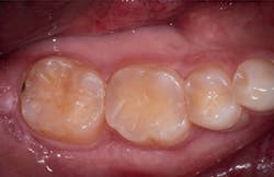 Figure 6: One-year follow-up Figure 6: One-year follow-up