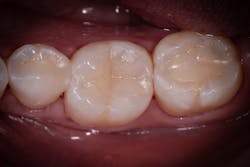 Figure 12a: Four-and-a half-year follow-up Figure 12a: Four-and-a half-year follow-up