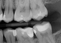 Figure 12b: Four-and-a half-year follow-up Figure 12b: Four-and-a half-year follow-up