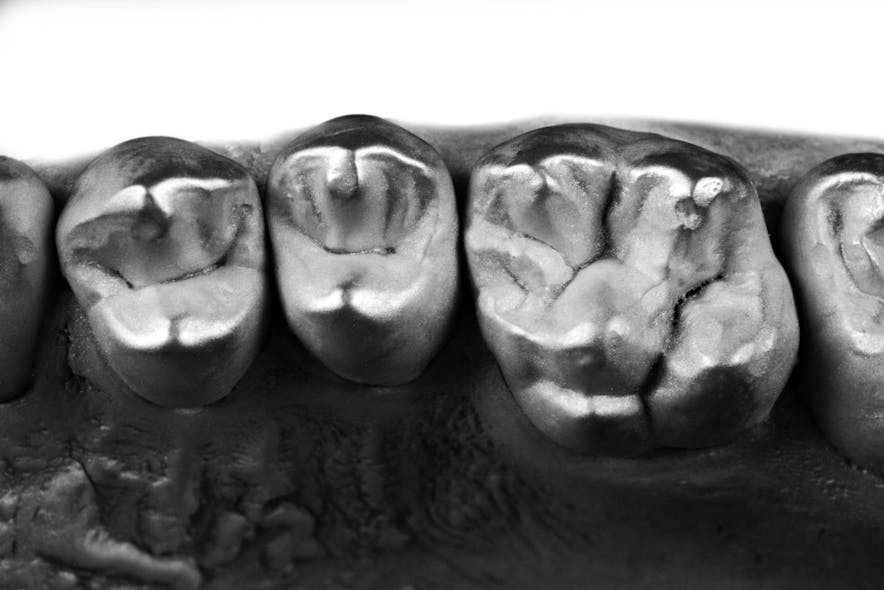 Figure 1: Analogue reproduction of natural teeth (stone cast coated with silver powder)