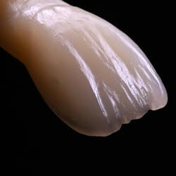 Figure 3: Composite resin specimen with histo-anatomic layering. Only two masses were used with internal effects in-between and surface texturing Figure 3: Composite resin specimen with histo-anatomic layering. Only two masses were used with internal effects in-between and surface texturing