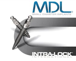Figure 3: Example of one-piece SDI 2 mm diameter Figure 3: Example of one-piece SDI 2 mm diameter