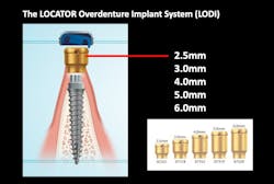 Figure 4: Example of Locator abutment on an SDI Figure 4: Example of Locator abutment on an SDI