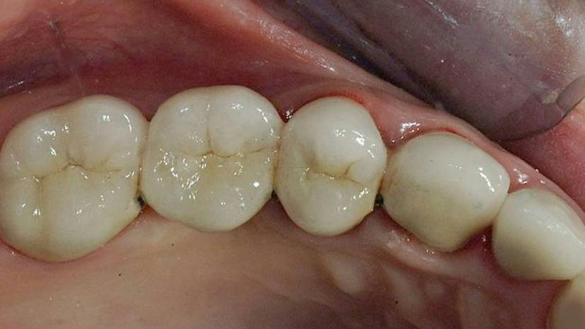 restorative-dentistry