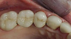 restorative-dentistry restorative-dentistry