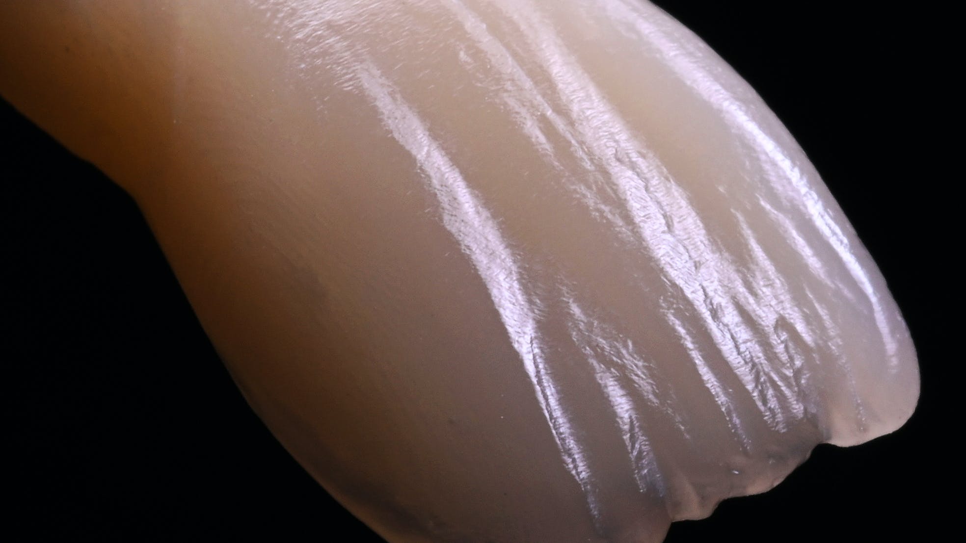 biomimetic-restorative-dentistry