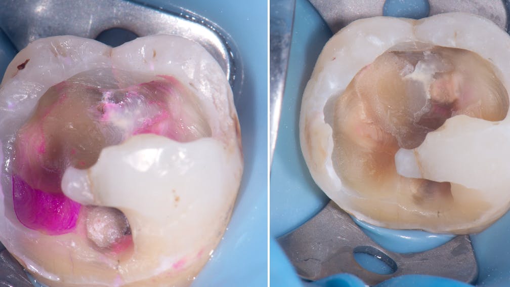 restorative-dentistry
