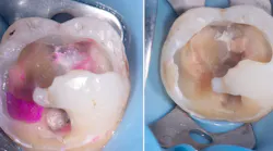 restorative-dentistry